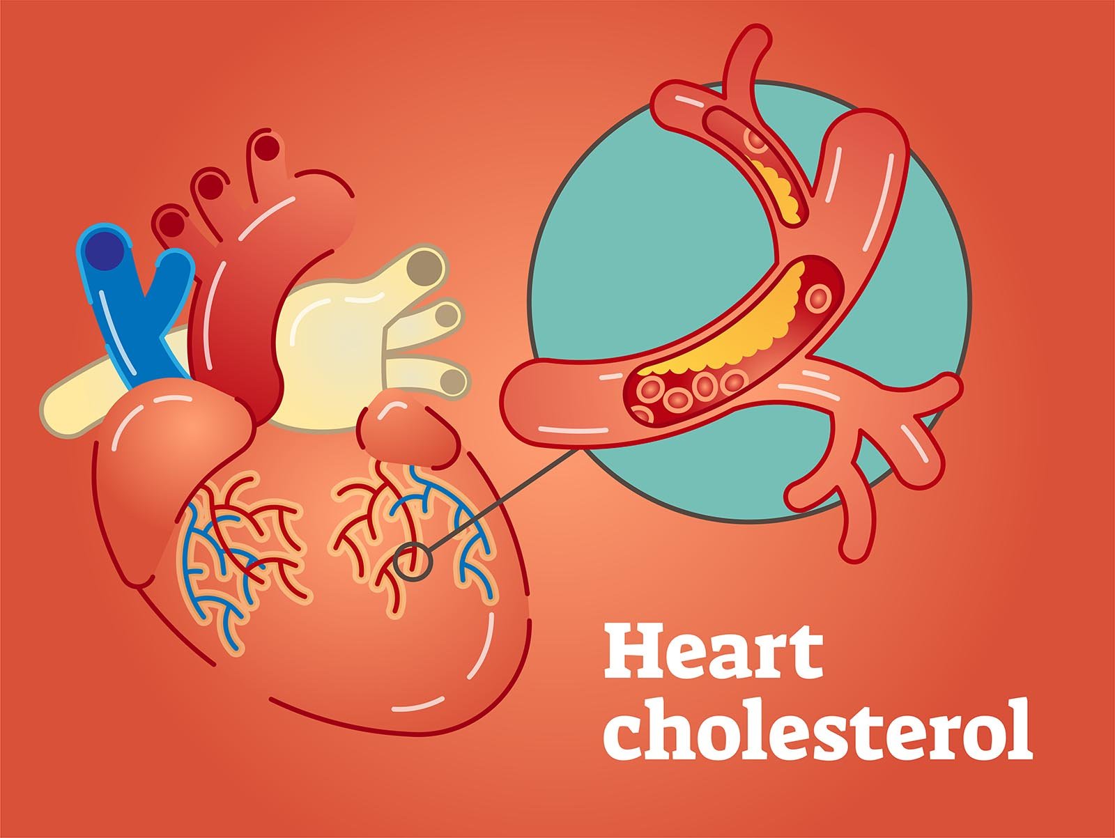 heart_cholesterol-digi-doc