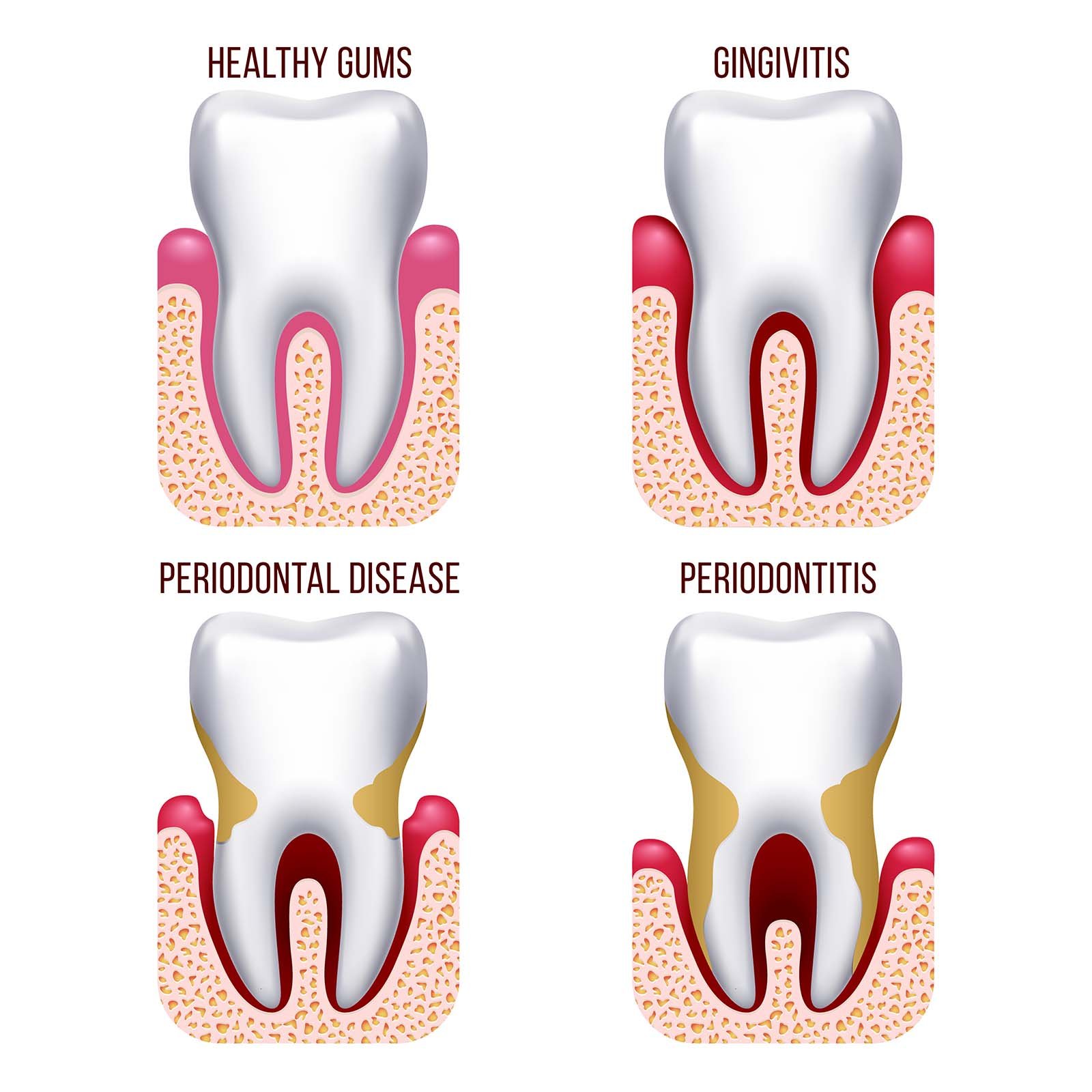 dental_problem_digi_doc